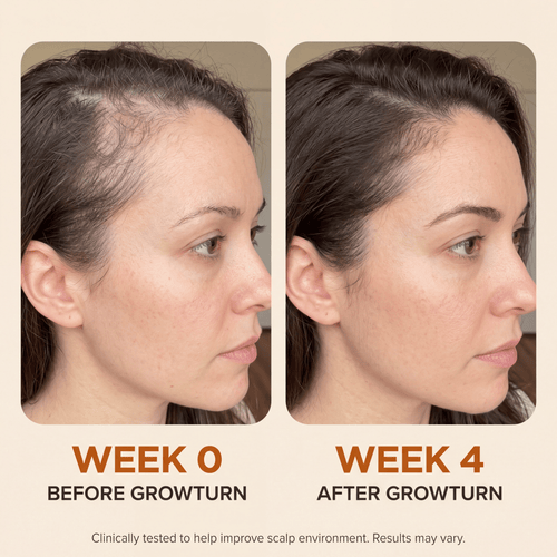 GROWTURN Hair Growth Serum