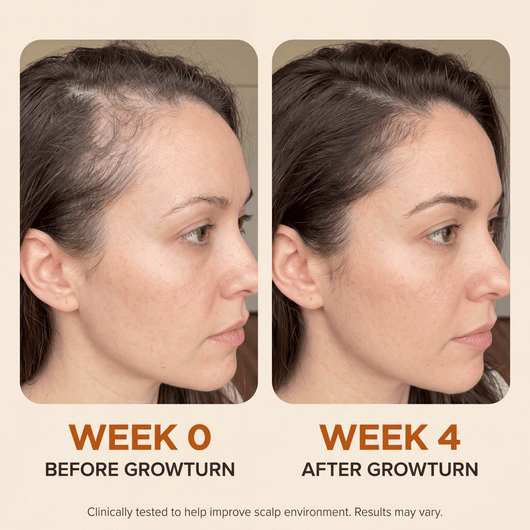 GROWTURN Hair Growth Serum - EmergingEra™