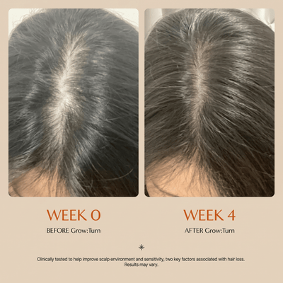 GROWTURN Hair Growth Serum - EmergingEra™