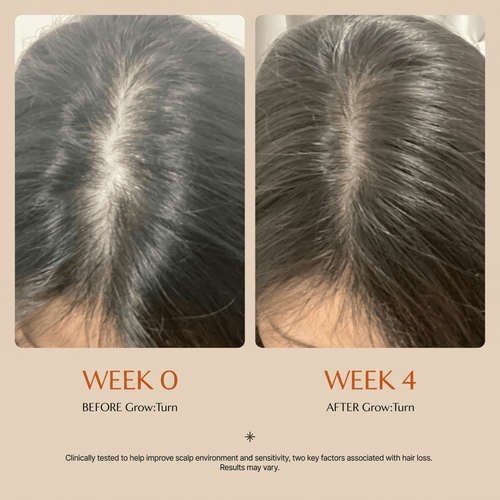 GROWTURN Hair Growth Serum